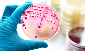 Какие требования предъявляются к бактериологическим исследованиям?